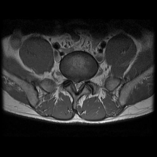 2005 MRI Horizontal