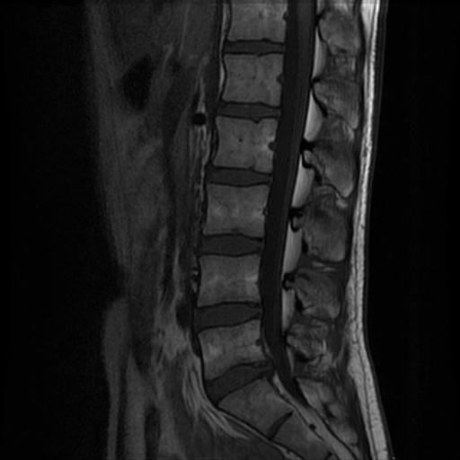 2005 MRI Vertical