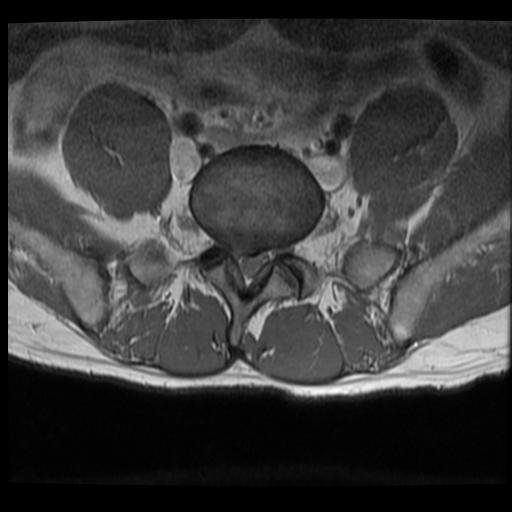 2007 MRI Horizontal