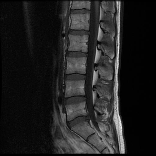2007 MRI Vertical